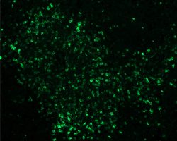 Thymus IHC-IF-Ag1