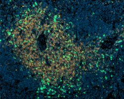 Thymus IHC-IF (Ag1+Ag2+DAPI)