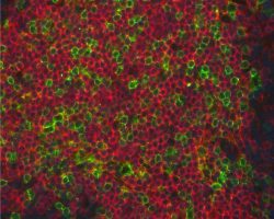 Double IHC-IF (FITC+CY5)