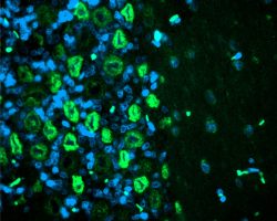 Brain IHC-IF (FITC+DAPI)