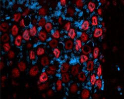 Brain IHC-IF (CY5+DAPI)