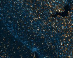 Astrocytes IHC-IF
