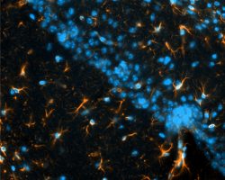 Hippocamus IHC-IF