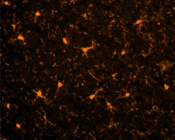 Macroglia-IHC-IF