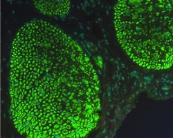 Penile Tissue IHC-IF