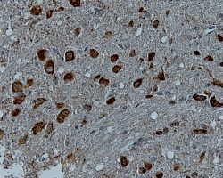 Brain IHC-P