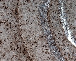 Brain IHC-P-GFAP