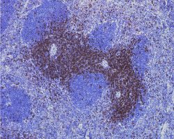 Spleen IHC-P