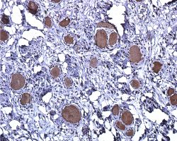 DRG IHC-P