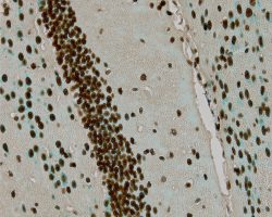 TUNEL Assay, Brain section treated with DNase