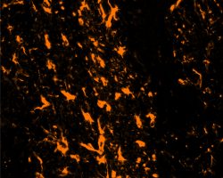 Brain IHC-IF (Ag3)