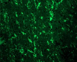 Brain IHC-IF (Ag4)