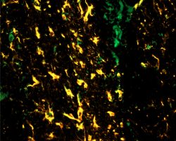 Brain IHC-IF (Ag3+Ag4+DAPI)