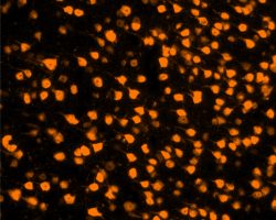 Brain IHC-IF (Ag5)