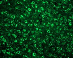 Brain IHC-IF (Ag6)