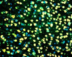Brain IHC-IF (Ag5+Ag6+DAPI)